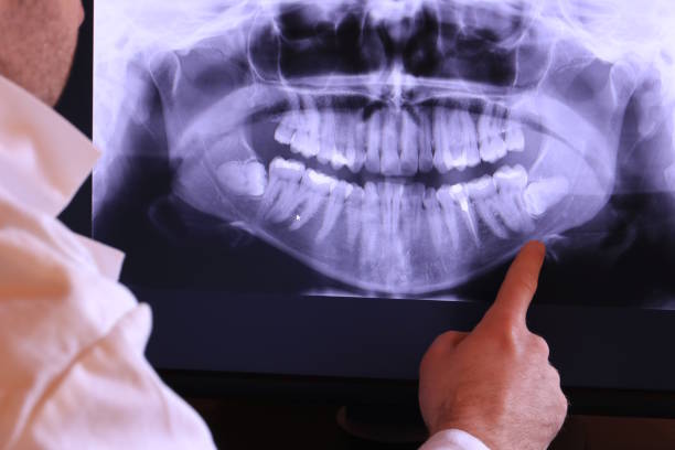 Best Weekend Emergency Dentist in Wahneta, FL
