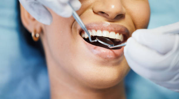 Best Emergency Tooth Extraction in Wahneta, FL