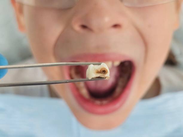 Best Emergency Orthodontic Repairs in Wahneta, FL